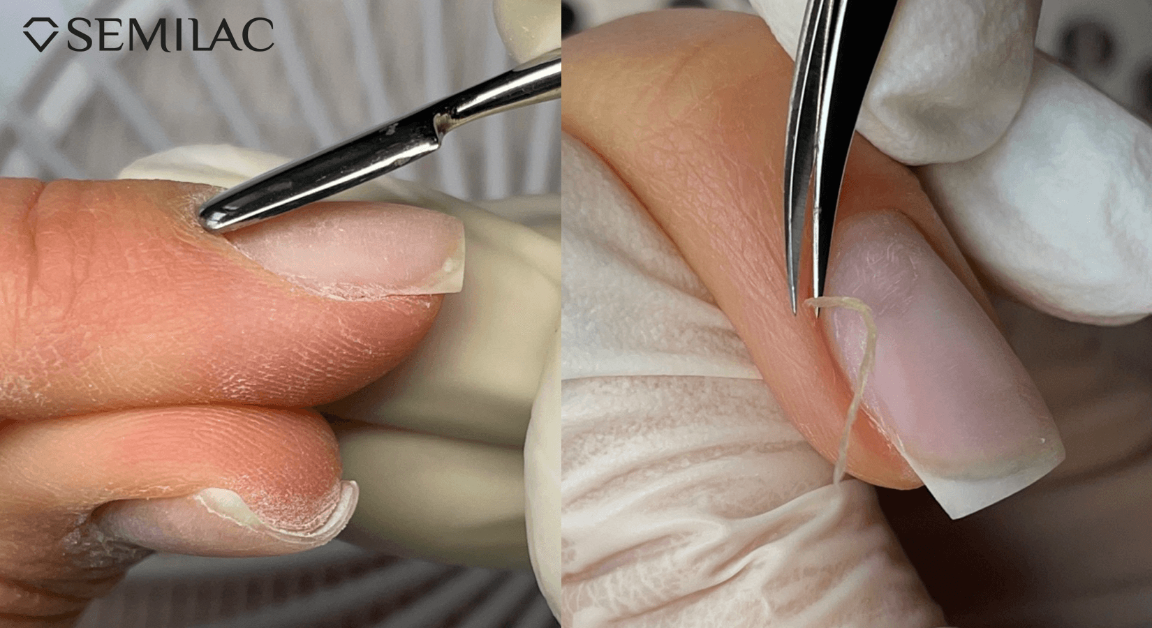 Is cutting cuticles safe?